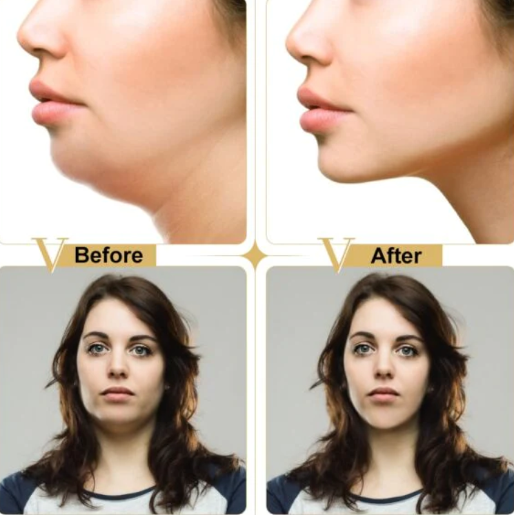 Maska za Zatezanje Lica